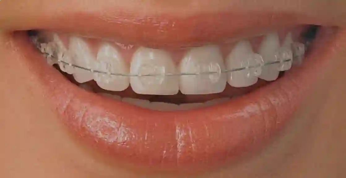 متخصص ارتودنسی دکتر نگاه بازقلعه