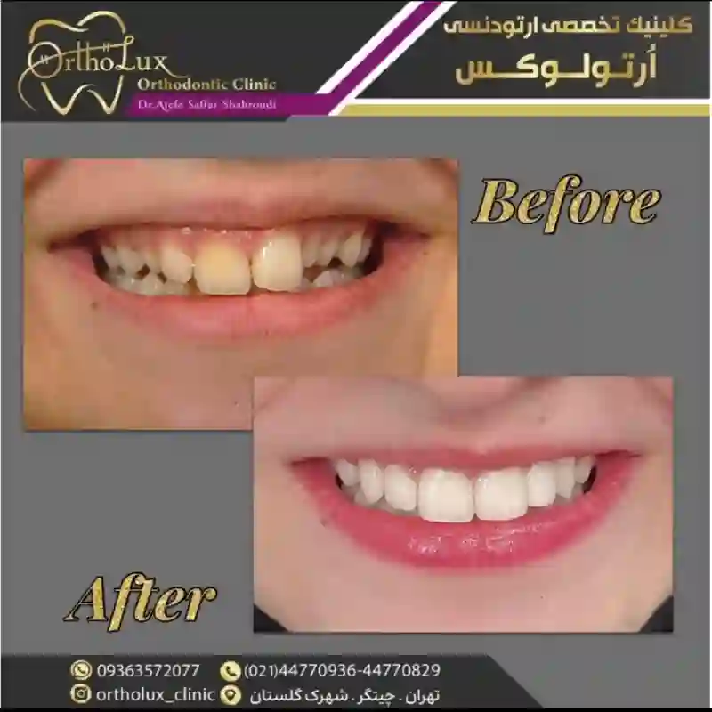 کلینیک تخصصی ارتودنسی ارتولوکس