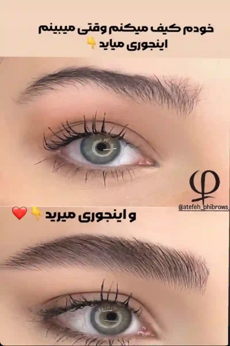 مرکز فیبروز و آرایش دائم عاطفه