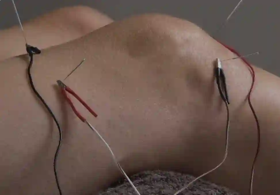 مرکز فیزیوتراپی و طب سوزنی دکتر احمدی