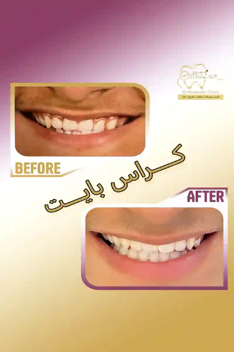 متخصص ارتودنسی (دکتر عاطفه صفار شاهرودی)