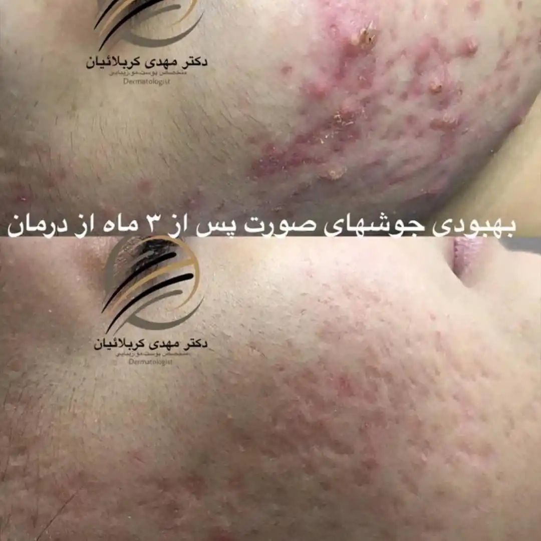  دکتر مهدی کربلائیان متخصص پوست و مو